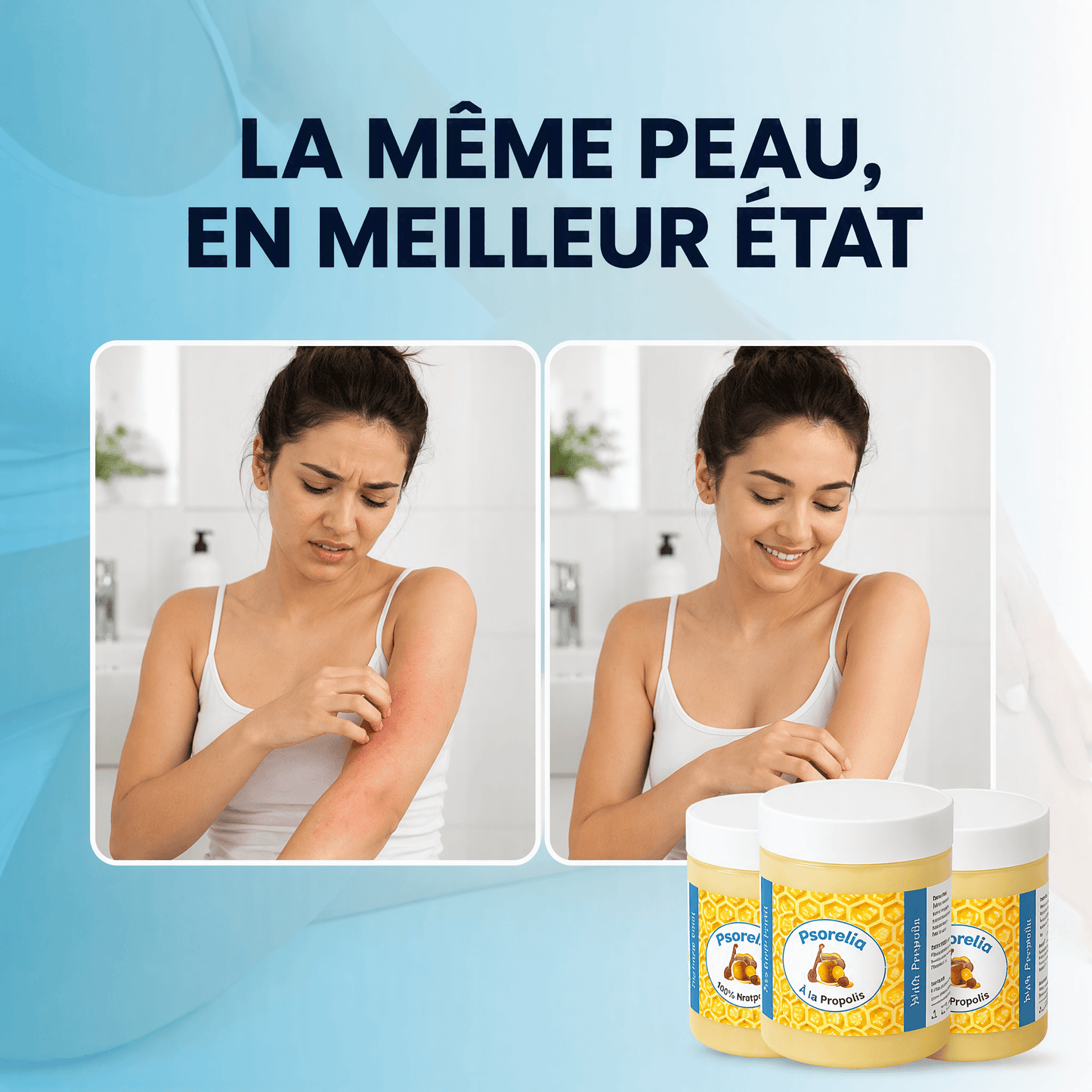 Psorelia - Baume réparateur pour l’eczéma et le psoriasis