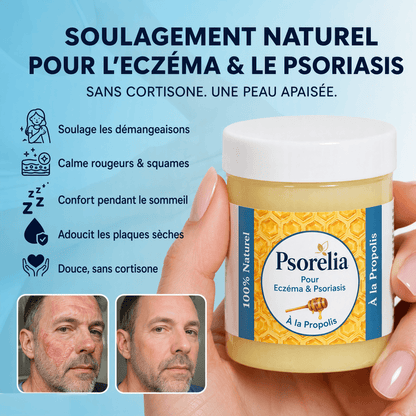 Psorelia - Baume réparateur pour l’eczéma et le psoriasis